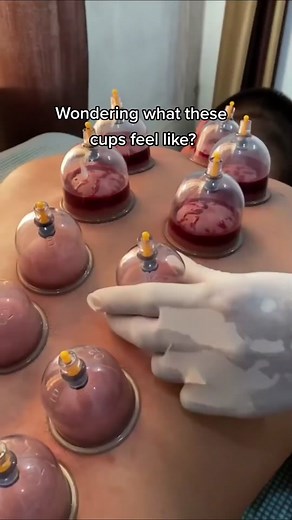 Cupping Chavix on TikTok