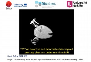 Bio-Inspired, Simulation-Coupled, Active Prostate Phantom