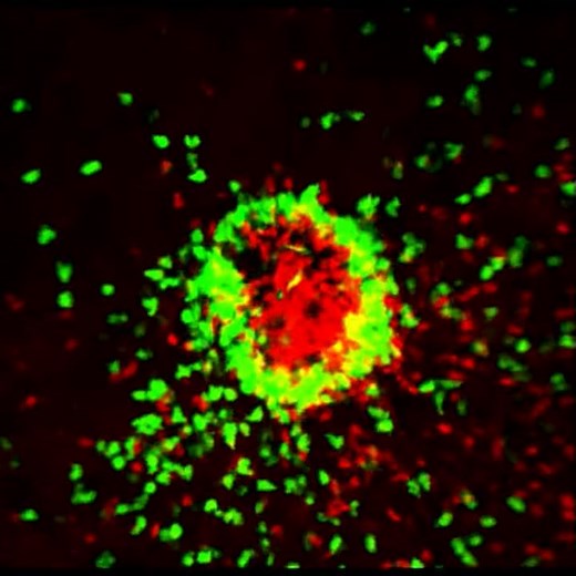 Role of integrins in neutrophil migration and swarm formation