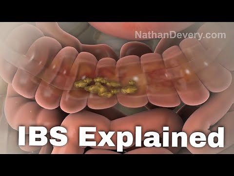 What is irritable bowel syndrome? IBS explained.