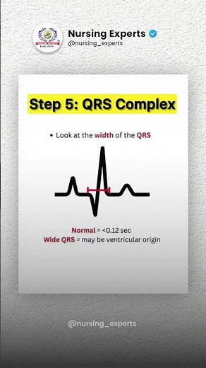 🫀 ECG BASIC – Step by Step ECG Interpretation | Nursing Experts