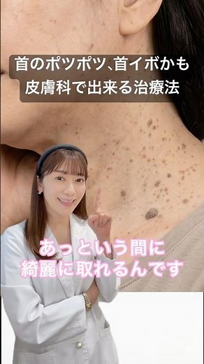 首のポツポツ、首イボかも。皮膚科でできる治療法を解説。