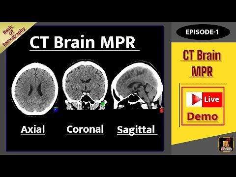 CT Brain MPR/Axial,Coronal, Sagittal/Live Demo/Basic Of Tomography/Episode-1.....