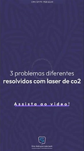 A day full of problems solved with the CO2 Laser ✅