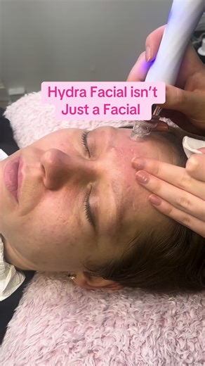 People don’t realise that hydra facial isn’t actually just a facial. It’s exfoliates and deep cleans the pores- yes! But I bet you didn’t know it also sculpts and lifts the face and neck using Radio Frequency No one ever talks about that part of the facial, it’s literally a whole facial cleansing and sculpting session! Genius! #hydrafacial #hydrafacialspecialist #hydratingskincare #hydrafacialuk