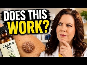 Can Castor Oil Really Remove Seborrheic Keratoses?