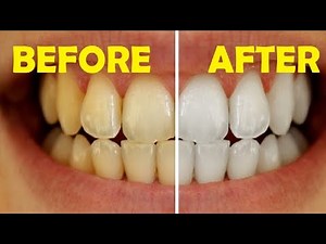 how to get rid of yellow teeth naturally in 2 minutes