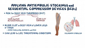 Video: Cardiovascular: Applying antiembolic stockings and sequential compression devices (for nursing assistant training) - Video Explanation! | Osmosis | Osmosis