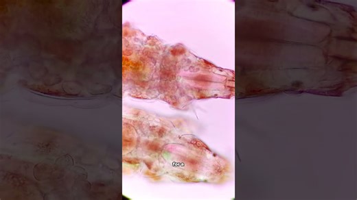 This Is The World's Smallest Animal!