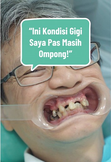 Solusi Gigi Ompong: Implan Gigi di Tanam