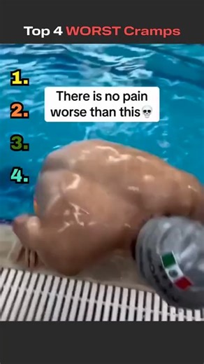 David Abbasi, MD | Orthopedic Sports Surgeon | That cramp that stops you in your tracks 😖⚡ Muscle cramps are sudden, involuntary contractions often caused by dehydration, electrolyte... | Instagram