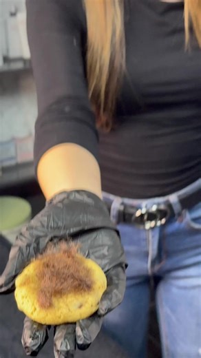 Laser Hair Removal at Venique - Sweet Spot