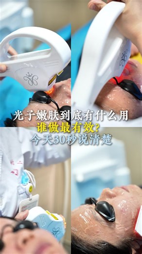 “光子嫩肤到底有什么用？谁做最有效？今天30秒说清楚”