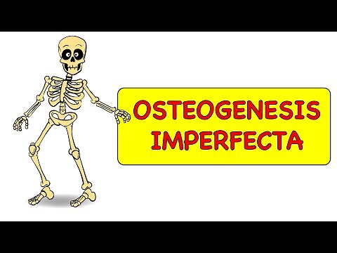 Osteogenesis Imperfecta - Introduction (Part - 1) (Causes & Features)
