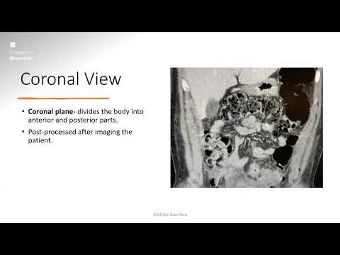 CT Blueprint Course Lesson 5: CT Image Acquisition and Parameters