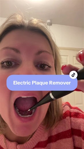 Electric Teeth Cleaner – High Frequency 31000/min Sonic Plaque Remover & Tartar Scraper with Whitening Mode USB Rechargeable Oral Hygiene Tool Achieve a cleaner, brighter smile at home with this powerful sonic electric teeth cleaner. Designed to help remove plaque, tartar build-up, stubborn stains   improve overall oral hygiene. Features high frequency vibration (31,000/min) for deeper cleaning results, easy USB charging, multiple heads   whitening assist mode. Perfect for coffee drinkers, smoke