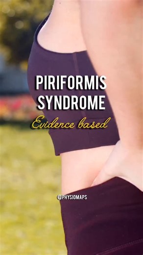 PhysioMaps | Physio Insights & Rehab on Instagram: "Piriformis syndrome diagnosis | Sciatica pain assessment | FAIR test physiotherapy | Hip pain causes | Buttock pain evaluation | Physiotherapy clinical tests | Sciatic nerve compression | Piriformis muscle tightness | Musculoskeletal assessment | Neurodynamics testing | Hip MRI findings | Piriformis syndrome symptoms | Clinical reasoning physiotherapy | Ortho physio assessment | Neurology physiotherapy | Physical examination skills | Pain while