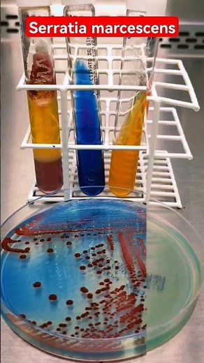Serratia marcescens on CLED Agar - Urine culture #Microbiology
