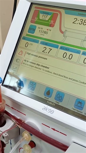 baxter Ak98 dialysis machin #dialysis #hospital #nurse #science #youtube #emergency #baby