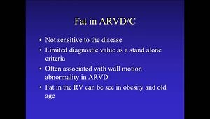 Arrhythmogenic Right Ventricular Cardiomyopathy: Diagnosis