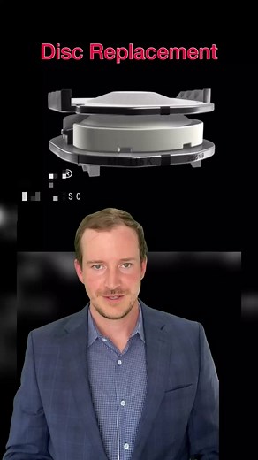 Understanding Disc Replacement: A Quick Explanation
