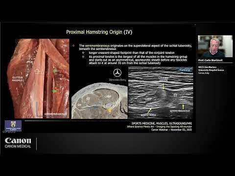 Ultrasound of Hamstring Injuries: What Should We Know and Look At