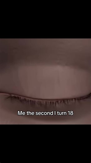 LASIK Eye Surgery: What You Need to Know at 18