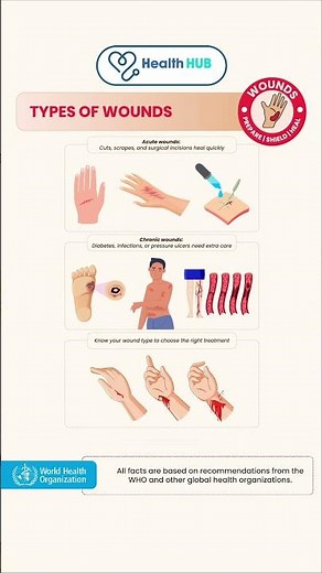 Types of Wounds Explained in 60 Seconds! 🩹🔍