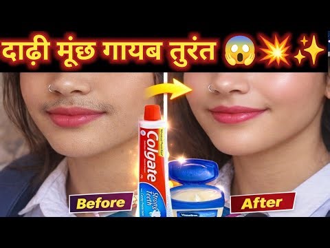 Doctor भी हैरान! 😱 Colgate से हटाएं Facial Hair |Remove Facial Hair Naturaly #desibeautytips