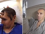 BMX star has his forehead replaced after nasty accident