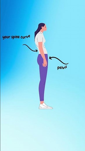 Sway Back Posture Explained | Causes and How to Correct I