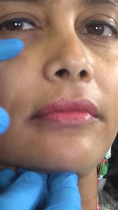 EZGEL - The All New, All Natural Filler