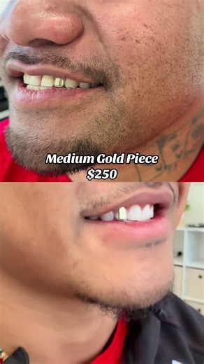 Stylish Medium Gold Teeth Pieces for $250