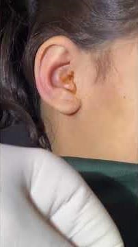 Gentle Ear Cleaning for Instant Relief/Soft Wax & Foreign Object Removal.