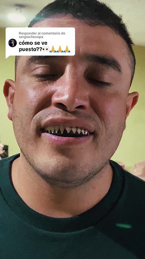 Protector Bucal para Boxeo: ¿Cómo elegir el mejor con brackets?