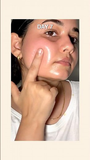 Snail Mucin For Acne Korean Glass Skincare Routine For Oily, Acne Prone Skin By Quench #ashortsaday