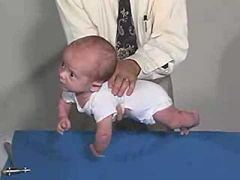 Neurology Exam, 3 Month: Positions - Ventral Suspension