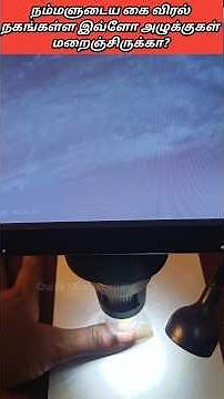 Revealing Nail Biting Germs Under Microscope | Dirty Nails Examined 🔬