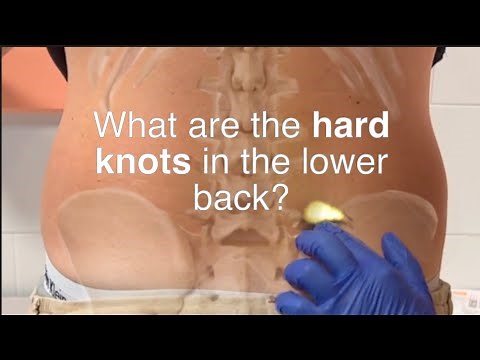What are the hard knots in the lower back? (...studying the back mice phenomenon for 6 years)