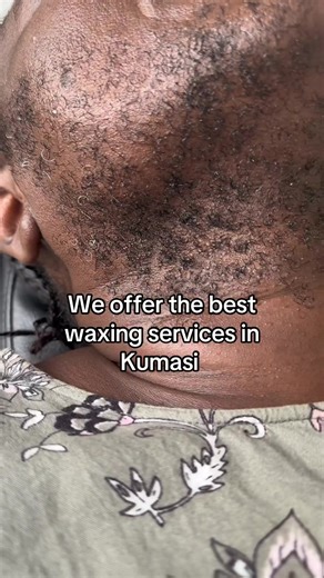 Top Waxing Services in Kumasi for Smooth Skin