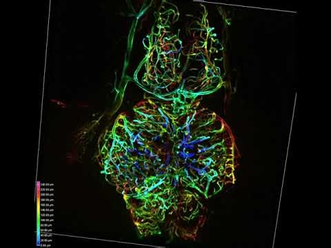 3D rendering of endothelial cells in the brain of an adult transgenic D. cerebrum