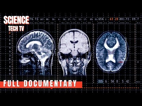 Tree Man Syndrome: When Skin Turns to Bark | Top 10 Secrets And Mysteries | Full Documentary