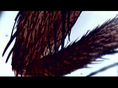 Annoyance Dealt With