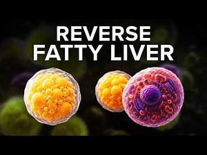 Is Your Liver in Danger? Understanding Fatty Liver Disease