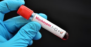 Monkeypox Outbreak: Testing, Vaccines, and More | Johns Hopkins Bloomberg School of Public Health