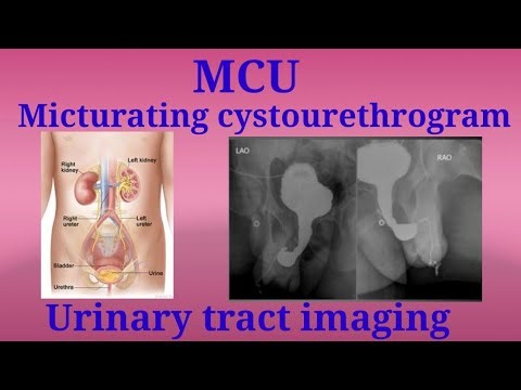 #Maturating cystourethrography Hindi explain | #MCU | #VCUG | #urinary tract image| #urethrogram#drt