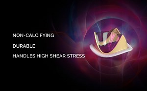 Tria人工心脏瓣膜