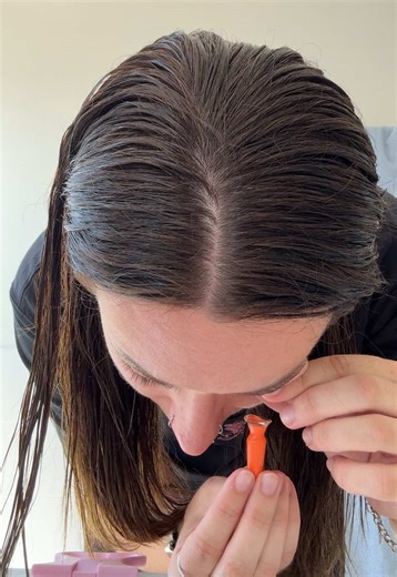 Shaky hands 🫨 #keratoconus #contactlenses #sclerallenses #optometry #eyehealth