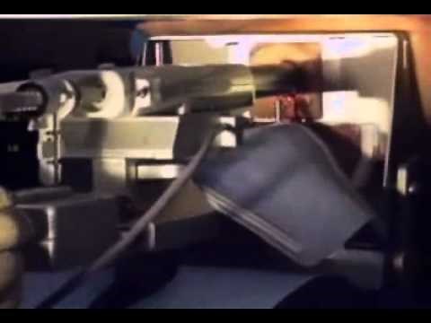 Minimally Invasive Needle Localization Breast Biopsy