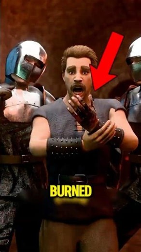 Burned Your Skin Don’t Use Ice or Toothpaste! 😱